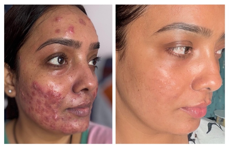 Poorani