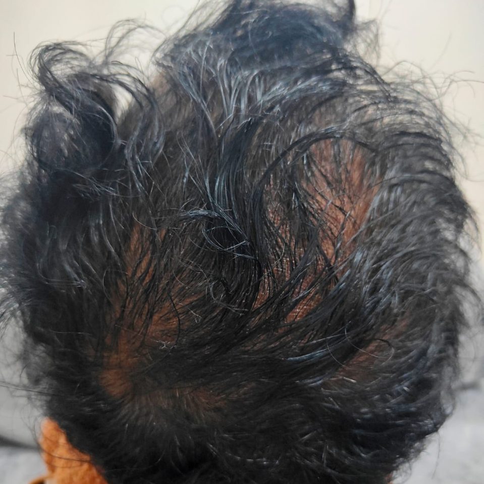 hari- after